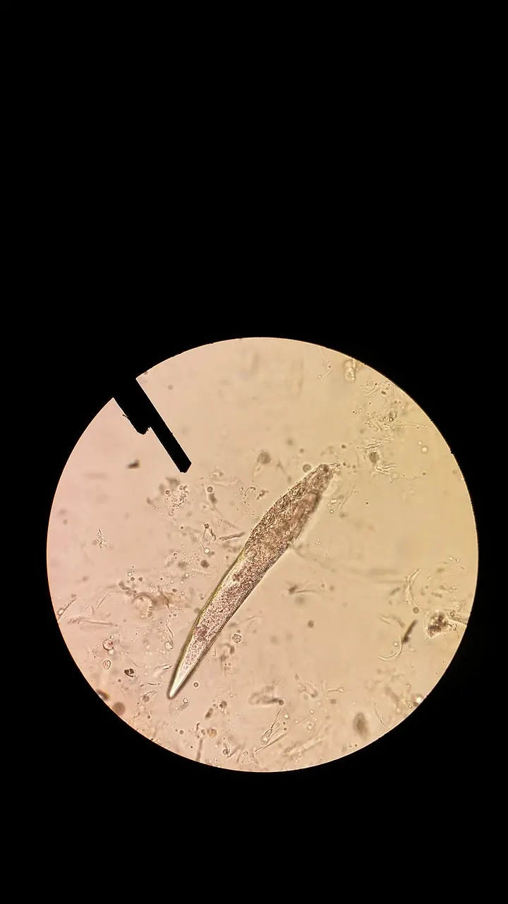 Demodex-Milbe